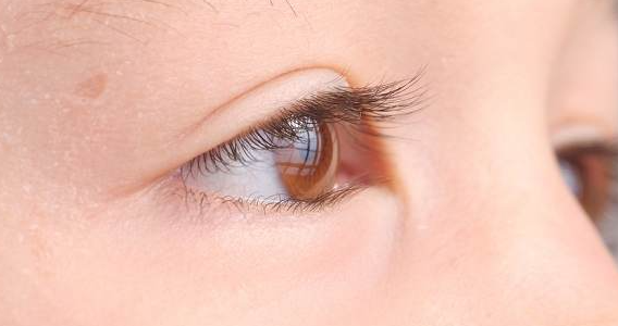 Kenali Jenis Penyakit Mata yang Bisa Dialami Bayi